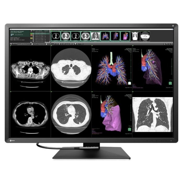 Медицински монитор EIZO RadiForce RX1270 12MP Цветен - Image 1