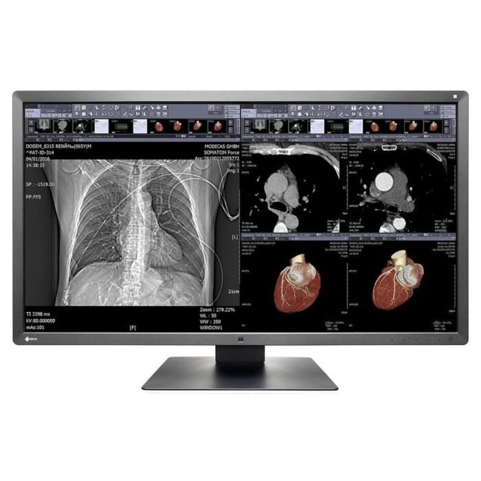 Медицински монитор EIZO RadiForce MX315W 8MP Цветен - Image 1
