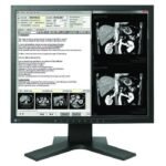 Медицински монитор EIZO RadiForce MX194 1MP Цветен