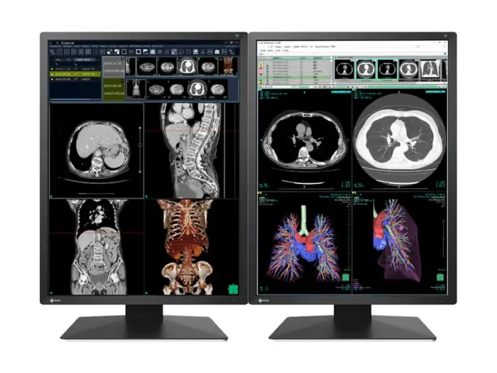 Медицински монитор EIZO Radi Force RX270 - 21.3" инч, 2MP Цветен LED - Image 2
