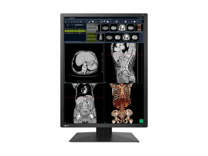 Медицински монитор EIZO Radi Force RX270 - 21.3" инч, 2MP Цветен LED - Image 1